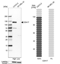 Cadherin-17 Antibody, Novus Biologicals:Antibodies:Primary Antibodies